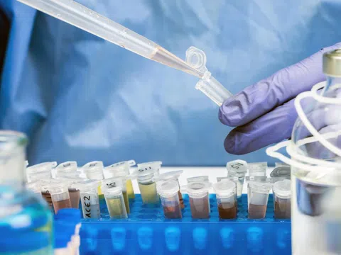 Mỹ nghi virus cúm gia cầm xuất hiện trong nước thải