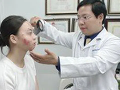 Uống thuốc tránh thai trị mụn, cô gái rước họa vào thân