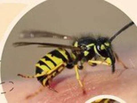 Tại sao ong vò vẽ đốt có thể gây nguy hiểm đến tính mạng?