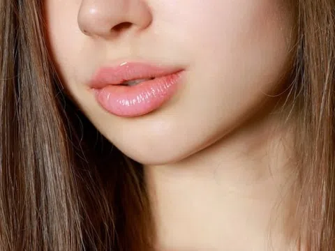 Hai loại thực phẩm người bị mụn nên tránh xa