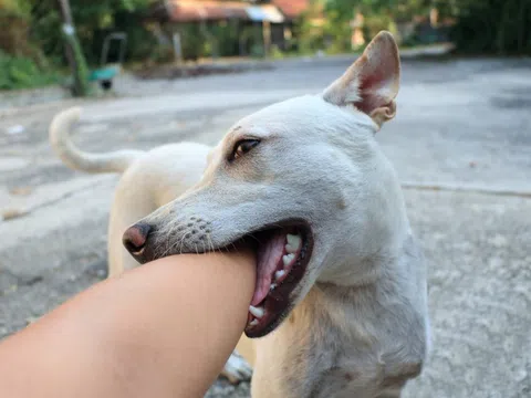 Trẻ bị chó cắn vào má ở Sơn La đã không qua khỏi