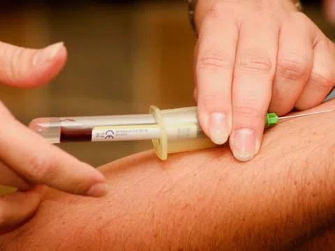 Các loại xét nghiệm không cần nhịn ăn