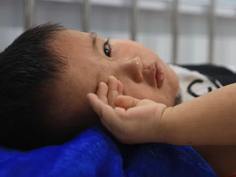 Tốc độ lây lan 'đáng sợ' của virus sởi