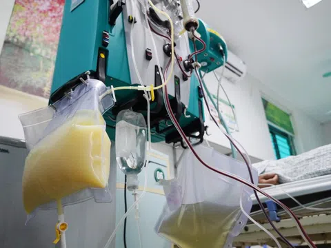 Đau bụng dữ dội, lọc máu thấy huyết tương trắng đục như sữa