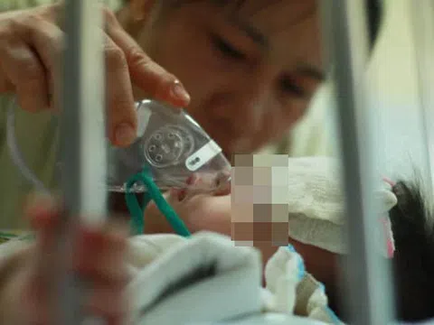 74% ca bệnh sởi ở TP.HCM là trẻ dưới 5 tuổi