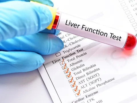 Nhìn vào mắt, phát hiện dấu hiệu ung thư gan