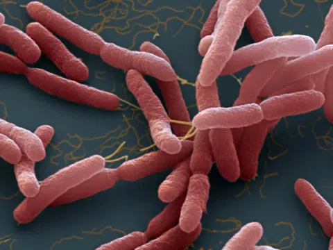 Bé gái 14 tuổi ở Đồng Nai nhiễm ‘vi khuẩn ăn thịt người’