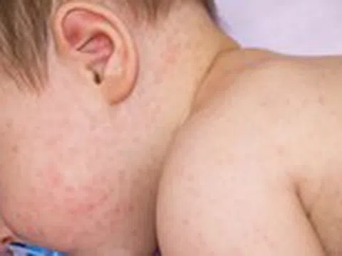 Tắm nước lá cây cho trẻ nhỏ: Nên hay không?