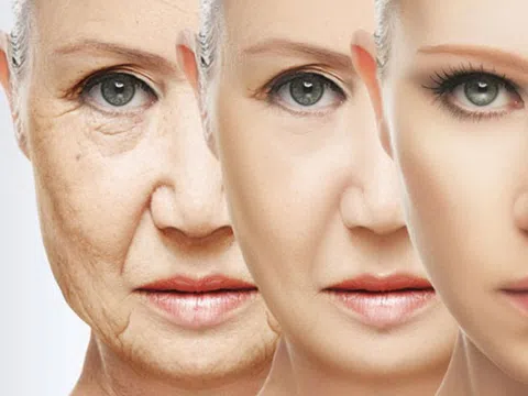Muốn ngăn ngừa lão hóa da cần biết những điều này