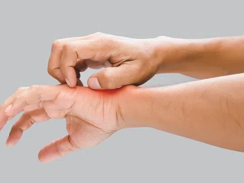 Cách nhận biết bạn đang bị nấm da