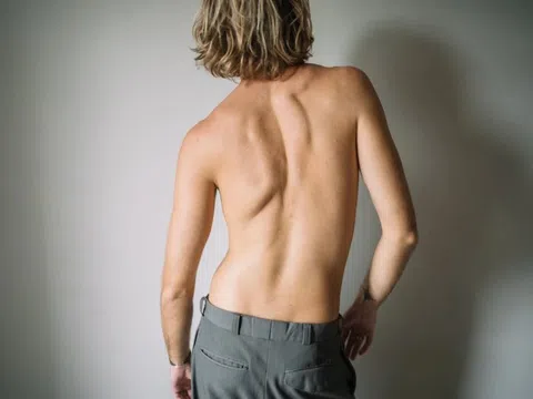 Thiếu hụt vitamin D sẽ gây những bệnh gì?