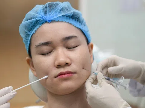Chi 10 triệu đồng để tiêm filler rãnh cười ở TP.HCM