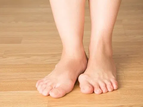 Bị bệnh gout nên ăn gì và kiêng gì?