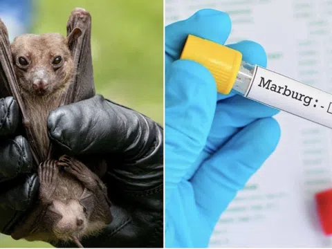 Hàn Quốc tăng cường kiểm soát biên giới, ngăn vi rút chết người Marburg