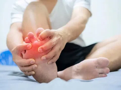 Dấu hiệu cơn đau cảnh báo bệnh gout bạn dễ bỏ qua