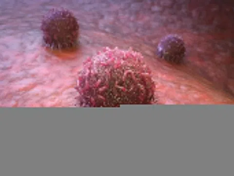 Những tác nhân gây ung thư phổ biến