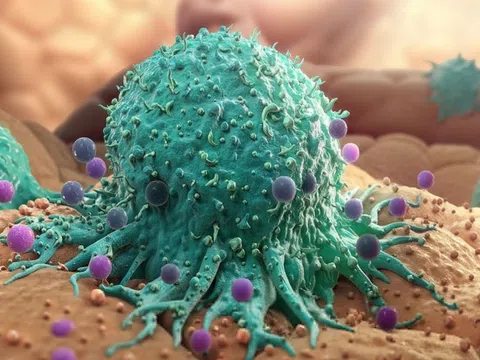 7 loại virus có thể dẫn đến ung thư nên biết