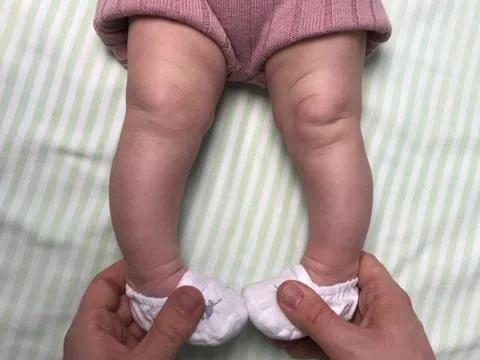 Những dấu hiệu cho thấy trẻ thiếu canxi