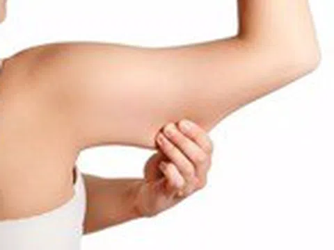 Giảm mỡ cánh tay bằng cách nào?