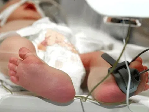 Dấu hiệu trẻ bị viêm não