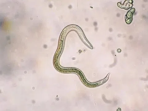 Cách các loại giun đường ruột lây lan