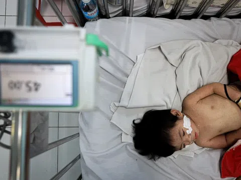 Nhiều ca nhập viện do mắc sởi biến chứng nặng