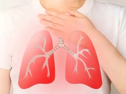 Phân biệt viêm phổi và viêm phế quản