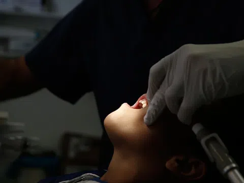 Bác sĩ chỉ rõ 7 bệnh răng miệng thường gặp nhất, phòng ngừa ra sao?