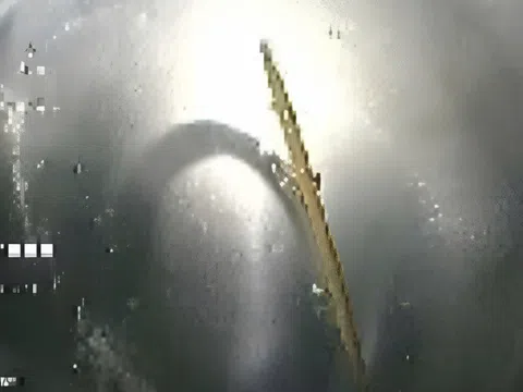 Cụ ông 71 tuổi thủng tá tràng vì ngậm tăm khi ngủ