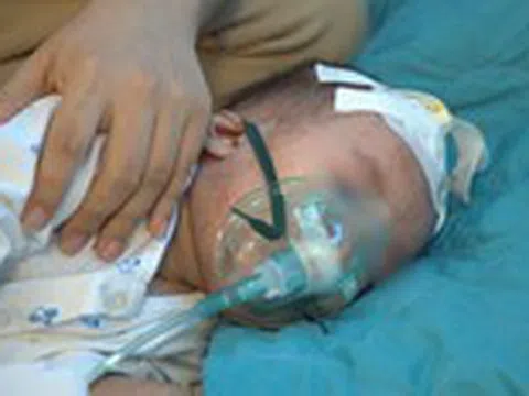 Ca mắc sởi ở Hà Nội tăng, nhiều trẻ phải thở oxy