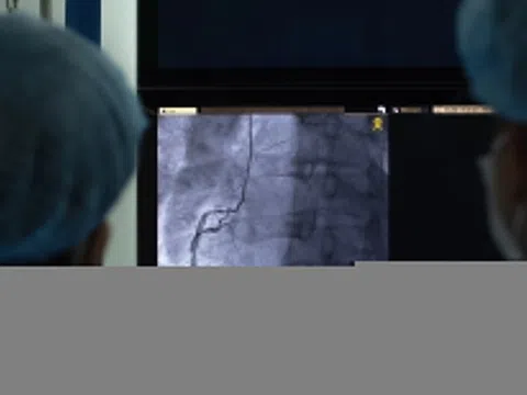 Nguyên nhân hàng đầu dẫn đến cơn nhồi máu cơ tim