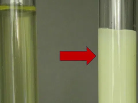 Nước tiểu màu trắng đục như nước vo gạo, cảnh báo bệnh gì?