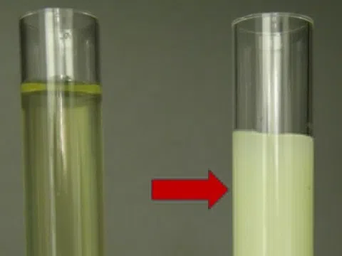 Dấu hiệu lạ ở nước tiểu cảnh báo bệnh nguy hiểm