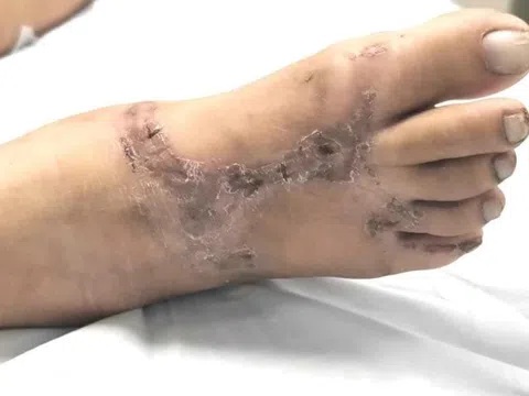 Thói quen hàng ngày khiến người phụ nữ đối mặt bệnh nguy hiểm