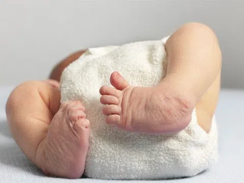 Câu hỏi thường gặp liên quan đến loạn sản sụn xương