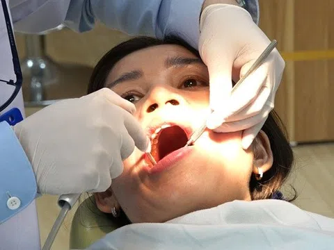 Hạn chế cao răng tại nhà bằng cách ăn uống cực đơn giản