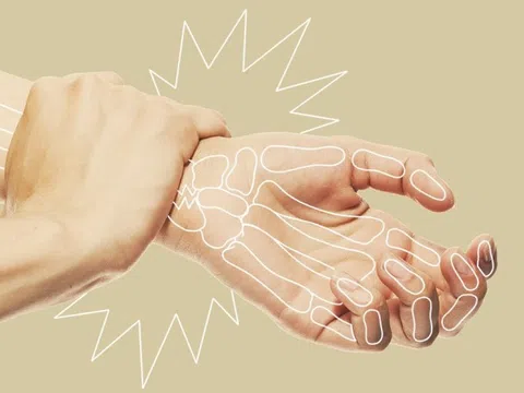 Dấu hiệu cảnh báo xương yếu