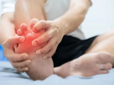 Các tác nhân phổ biến gây bệnh gout
