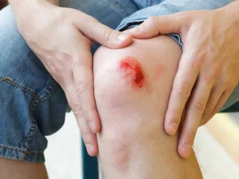 6 bước chăm sóc vết thương hở mau lành