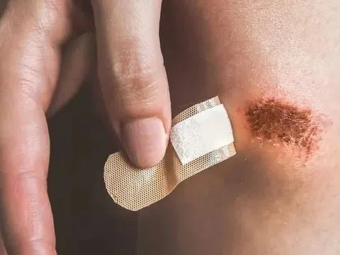 Vì sao vết thương của bạn lâu lành?