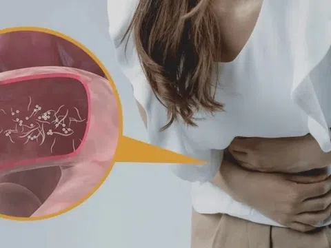 9 dấu hiệu 'tố cáo' bạn có thể bị nhiễm sán dây