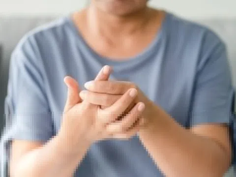 Nhận biết dấu hiệu bệnh gout ở bàn tay