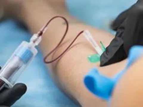 Xét nghiệm máu phát hiện ADN ung thư từ 3 năm trước khi chẩn đoán