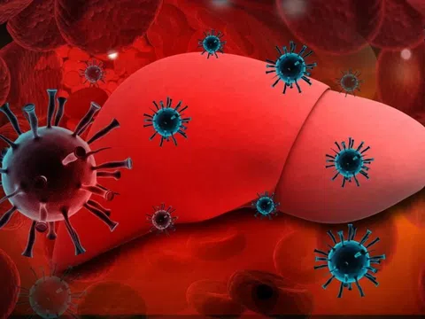 Viêm gan virus là bệnh gì?