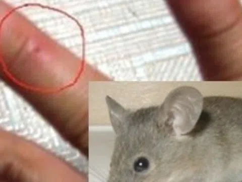 Những bệnh có thể lây nhiễm từ chuột và cách phòng