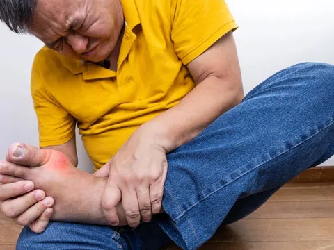 Người bệnh gout cần kiêng ăn gì?