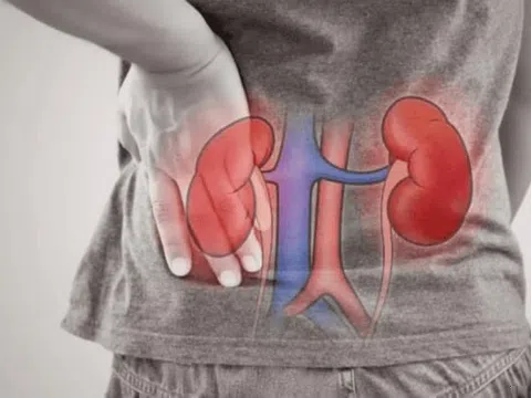 5 dấu hiệu cảnh báo sớm chức năng thận suy giảm