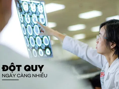 Vì sao đột quỵ ngày càng nhiều?