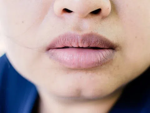 Dấu hiệu phổi chứa nhiều độc tố biểu hiện ngay trên mặt