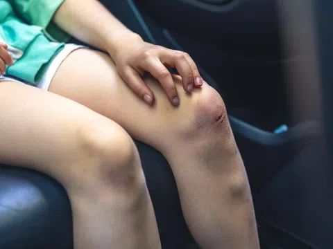 Dấu hiệu cảnh báo đường ruột có thể chứa đầy độc tố